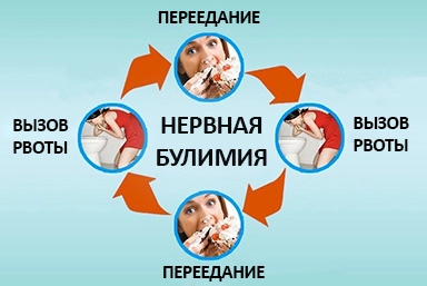 Лечение булимии в Успенском
